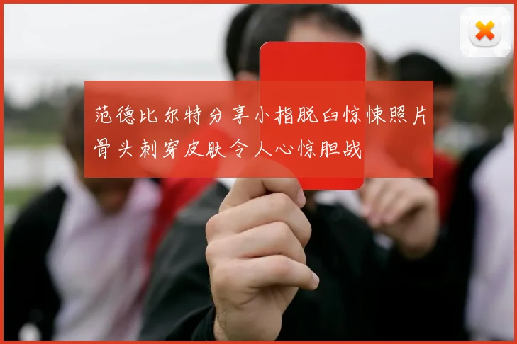 范德比尔特分享小指脱臼惊悚照片骨头刺穿皮肤令人心惊胆战